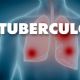 Prefeitura realiza campanha para alertar e formas de preveno da Tuberculose